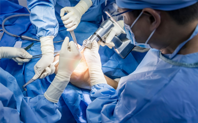 Knee Replacement